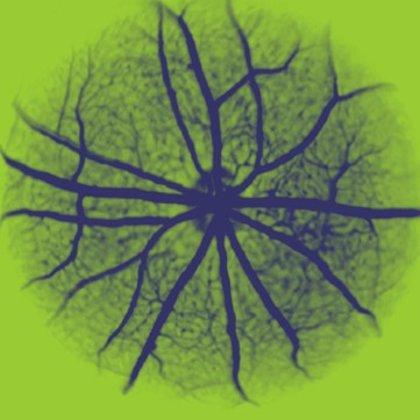 Retinal angiography