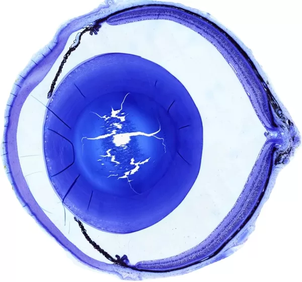 Sagital section of a mouse eye
