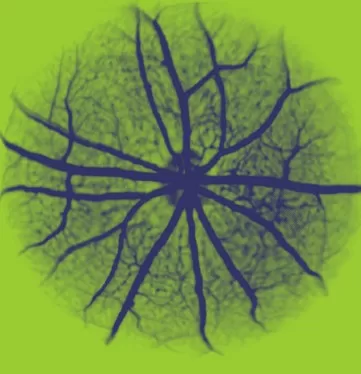 Retinal angiography